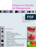 Acquired Defects of Maxilla and Management