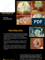 Biomateriales Preparacion Cavitaria Final