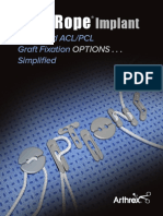 Tightrope Implantpcl Graft Fixation Options Simplified