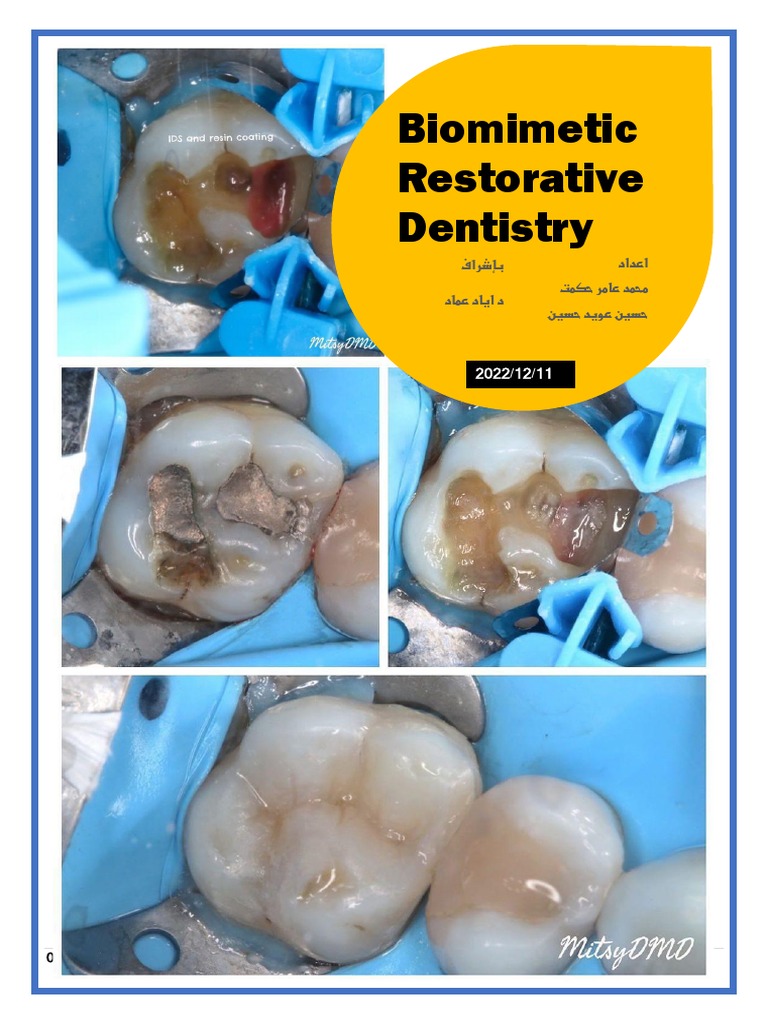 Biomimetic Restorative Dentistry PDF Tooth Enamel Dentin