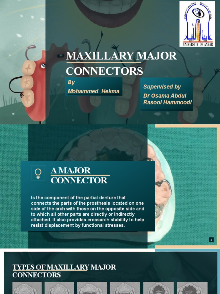 Prosthetic Maxillary Major Connectors PDF Dentistry Branches