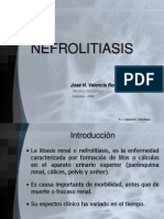 Nefrolitiasis