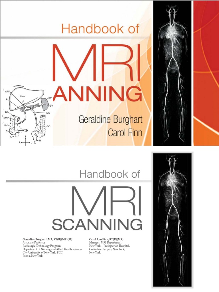 Handbook of MRI Scanning. by Burghart, Geraldine Finn, Carol Ann | PDF ...