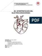 Interpretacion de EKG