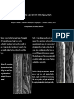 Report of Three Cases With Rare Spinal Epidural Tumors