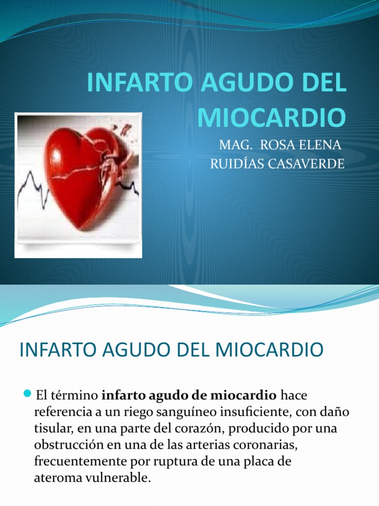 Infarto Agudo de Miocardio: Causas y Síntomas | PDF | Infarto de ...