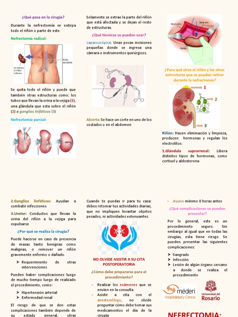 Nefrectomía: Guía para Pacientes | PDF | Riñón | Cirugía