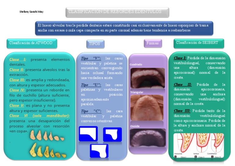 Clasificación de Rebordes Edéntulos | PDF