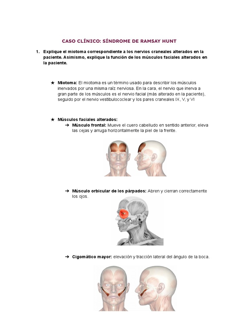 Síndrome de Ramsay Hunt y Dislipidemia | PDF | Aterosclerosis | Inflamación
