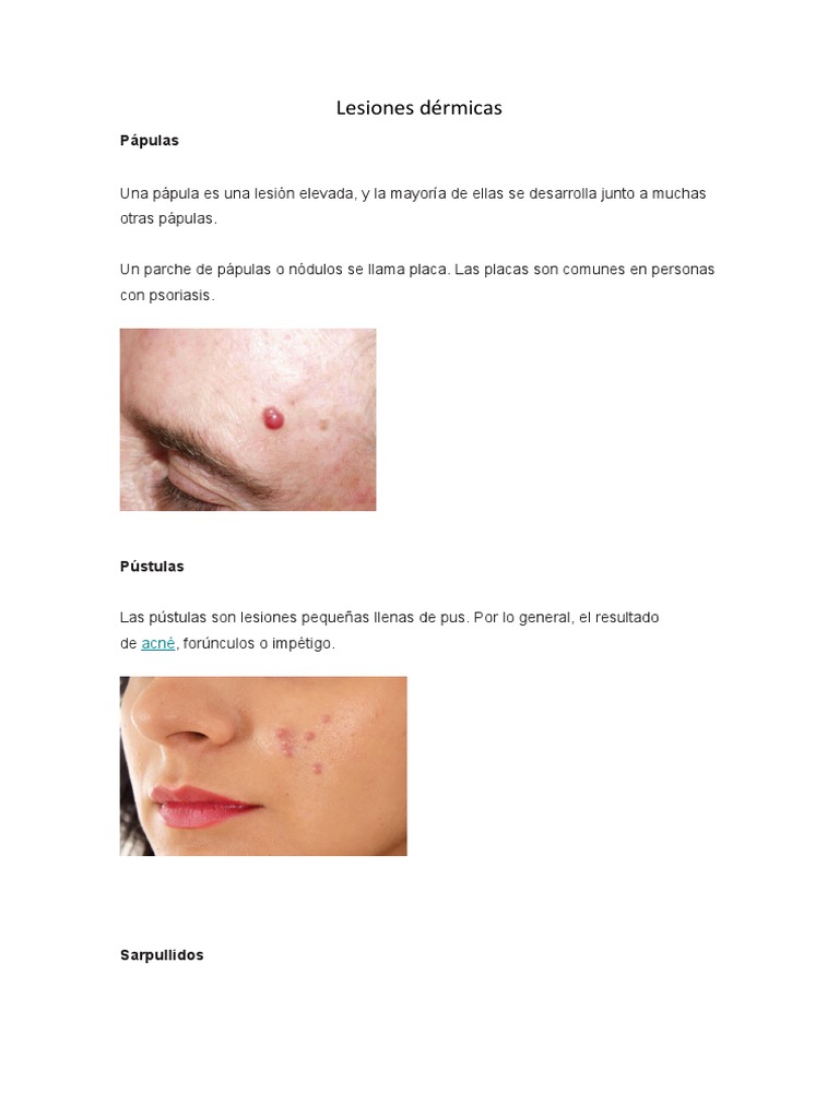 lesiones-d-rmicas-pdf-herpes-simple-staphylococcus-aureus