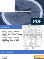 Hematomul Subdural