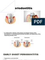 Periodontitis