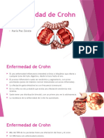 Enfermedad de Crohn