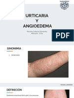 12 Urticaria y Angioedema