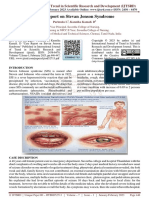 Case Report On Stevan Jonson Syndrome