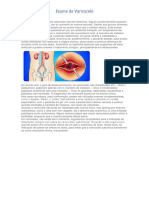 Exame de Varicocele em Homens