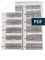 electrocardiogramas ejercicios