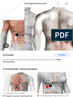 Cancer de Prostata Con Biomagnetismo - Búsqueda de Google