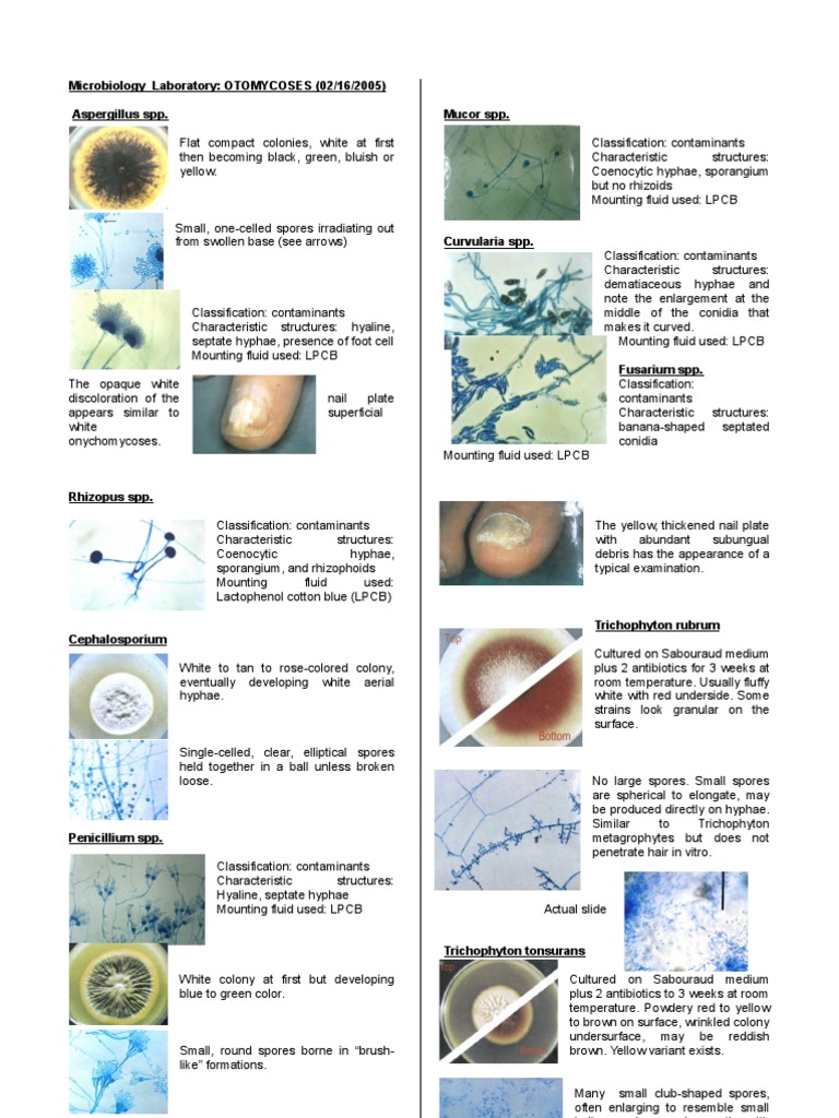 Mycology Lab2 | Fungus | Nature