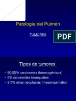 Tumores de Pulmon y EPOC