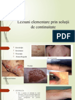 LP4 Leziuni Elementare Sol de Continuitate, Deseuri, Neincadrabila