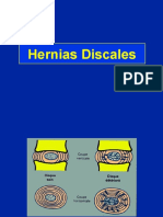 2-Hernias discales.