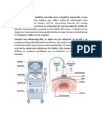 ULTRASONOGRAFIA