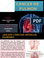 Cancer de Pulmon