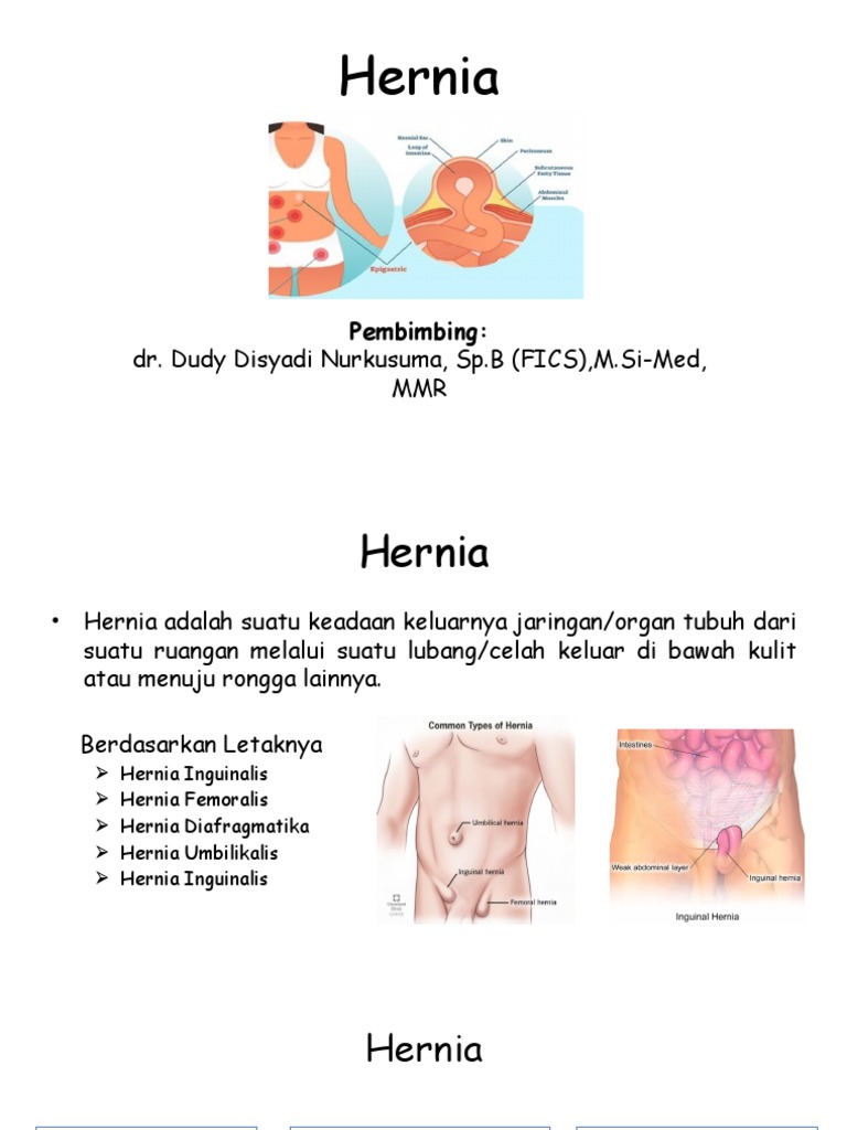 Jenis dan Penanganan Hernia | PDF | Pengembangan Diri | Kesehatan Holistik