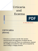 Eczema