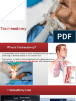 Tracheostomy