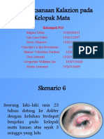 F10 Skenario 6 Kalazion