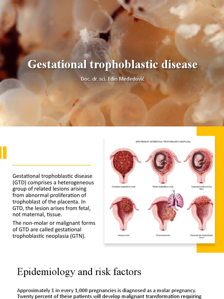 overview-of-gestational-trophoblastic-disease-pdf-human-chorionic