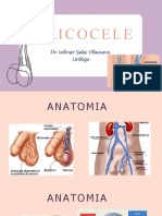 Varicocele