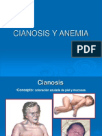 Anemia y Cianosis