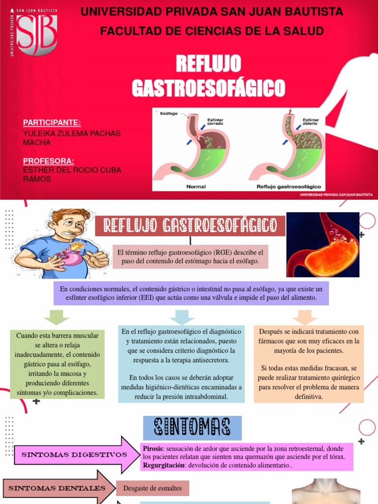 Tratamiento del Reflujo Gastroesofágico | PDF | La enfermedad por ...