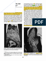 Repair of Soft Tissue-Root Interfase by Stahl (1977)