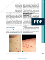 Fitzpatricks Dermatology 9th Edition 3121
