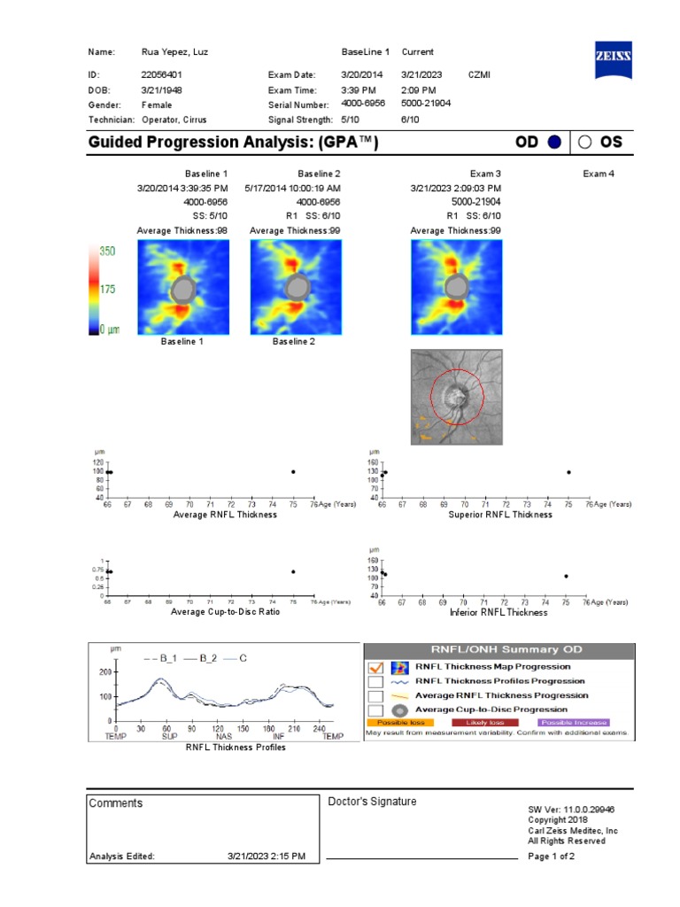 Rua Yepez Luz 22056401 19480321 Female Optic Disc Cube