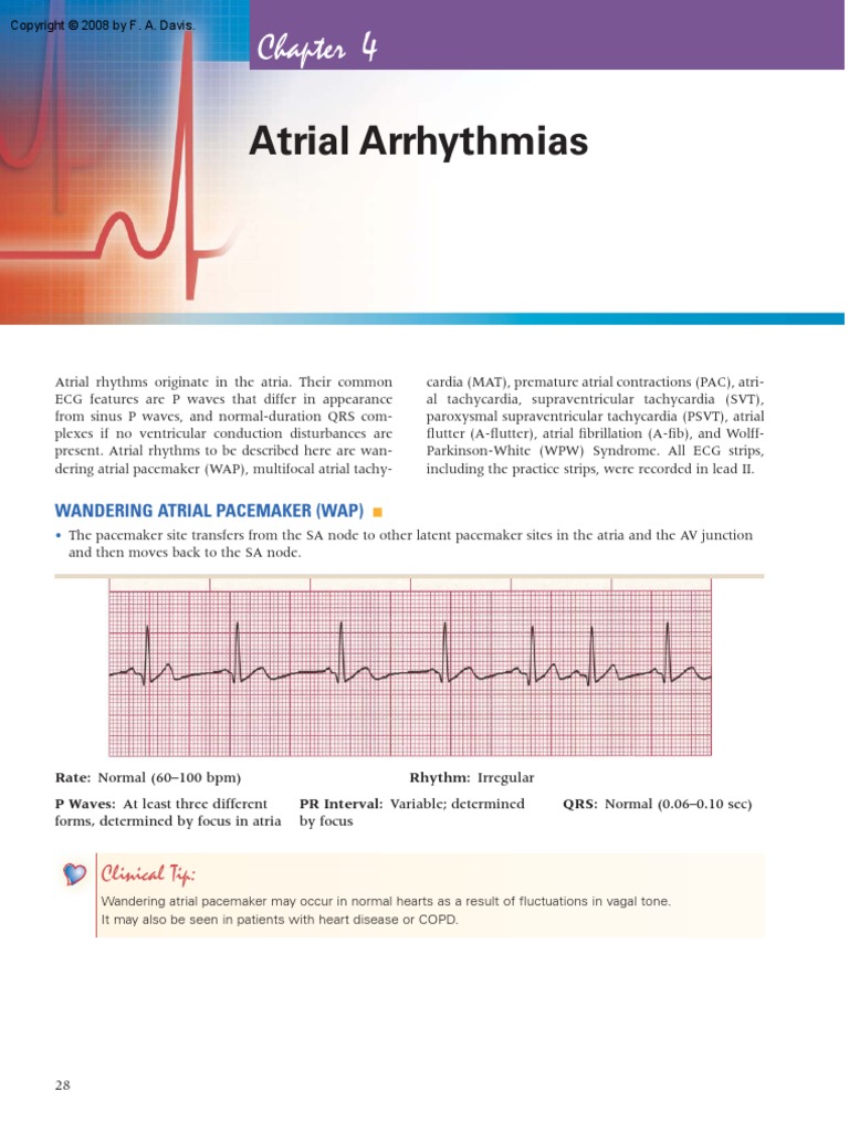 Atria Arrythmia Test | Download Free PDF | Electrocardiography ...