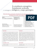 Técnica de Ortodoncia Osteogénica