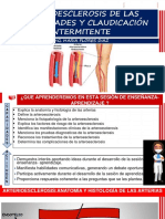 Arterioesclerosis de Las Extremidades y Claudicación Intermitente