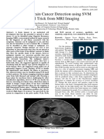 Automatic Brain Cancer Detection Using SVM Kernel Trick From MRI Imaging
