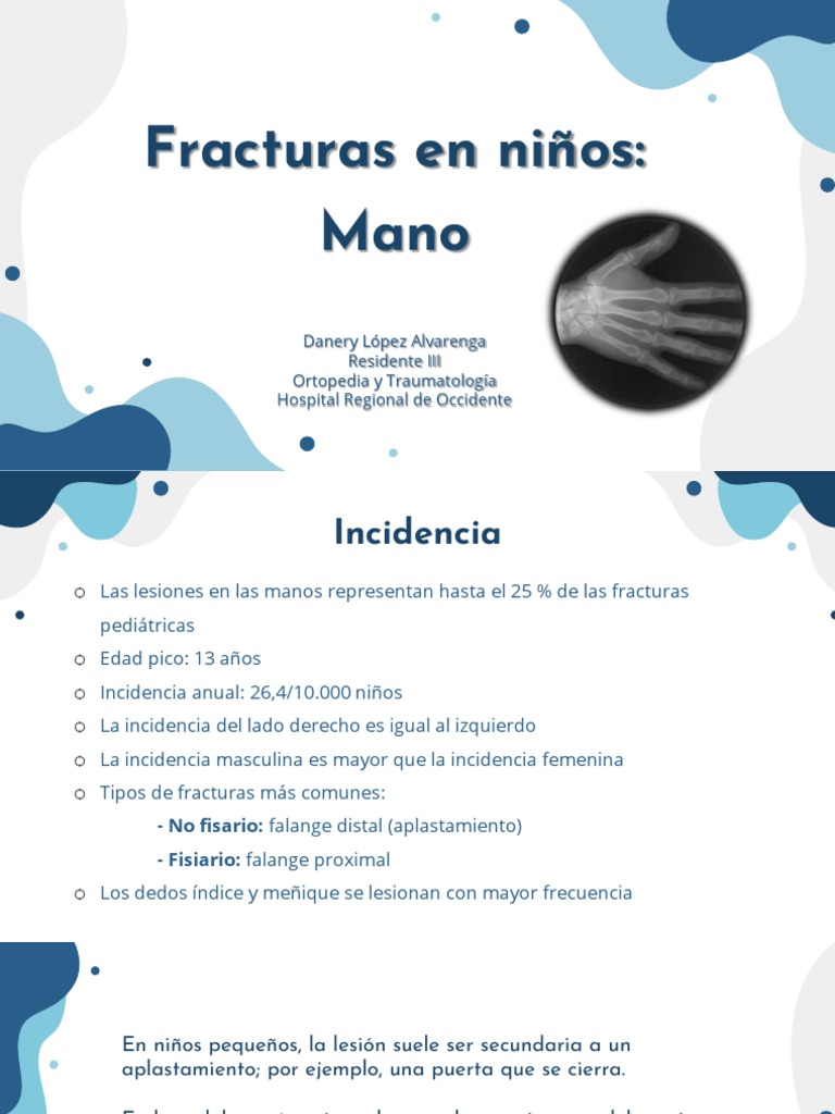 fracturas-de-mano-en-ni-os-gu-a-cl-nica-pdf-historia