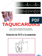 TAQUICARDIAS