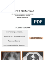 Cancer Pulmonar