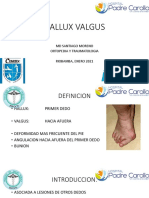 Hallux Valgus