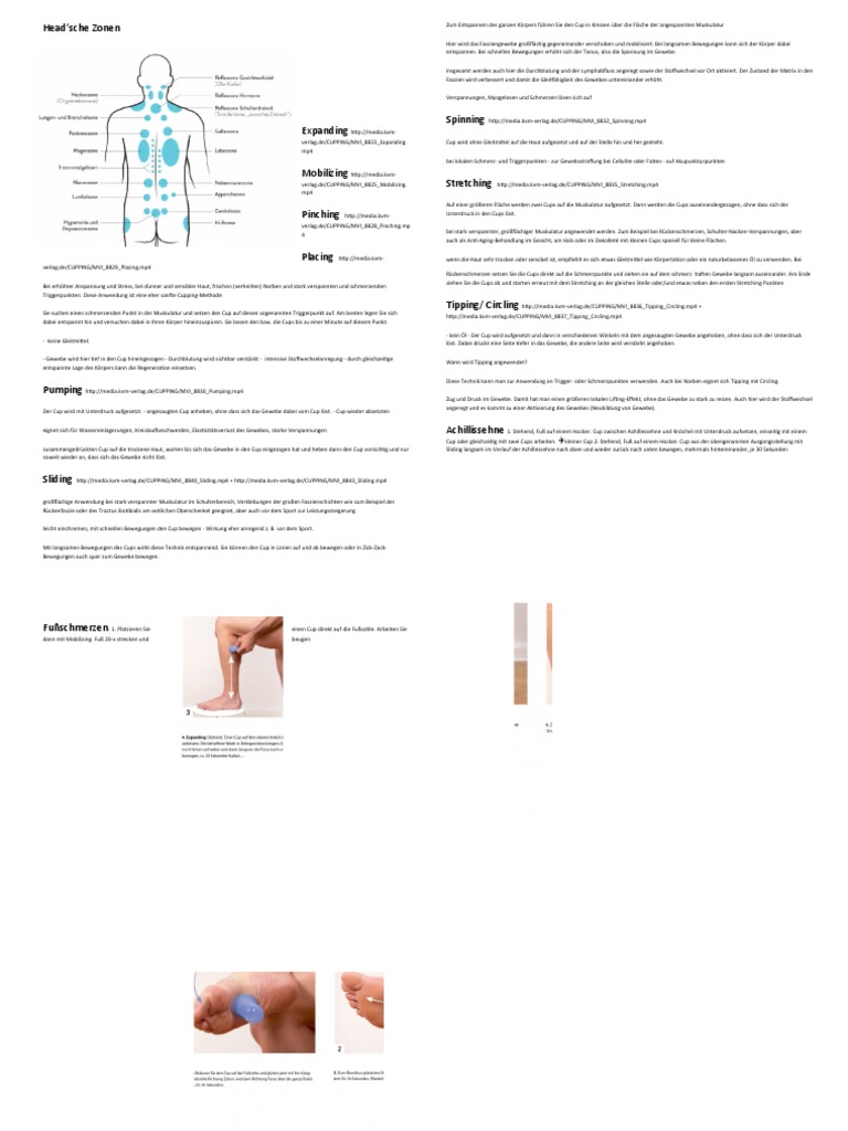 Cupping | PDF