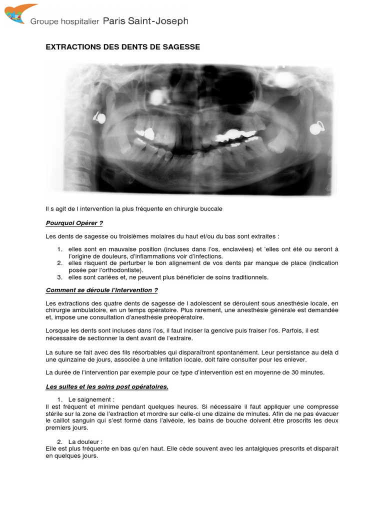 Extraction des Dents de Sagesse Guide Complet PDF Wellness — free download
