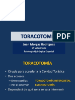 Tema 48. Toracotomia. Hernia Diafragmática